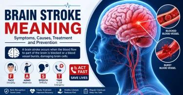 brain stroke meaning